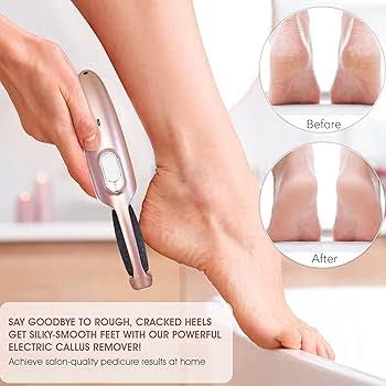 Rechargeable Electric Pedi Foot Filer Effective Callus Remover For Soft Smooth Feet With Easy Use And Reliable Performance